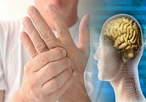 نشانه های خاموش ابتلا به ام اس
