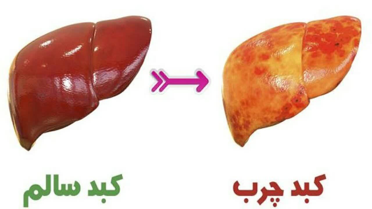 کبد؛ پرمشغله‌ترین اندام درونی انسان