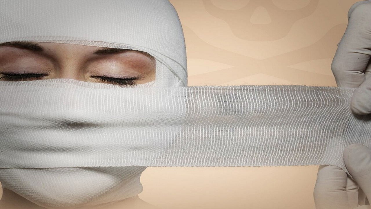 اسیدپاشی مرد کینه‌جو به همسر سابقش / دادگاه حضانت فرزندم را به من داد