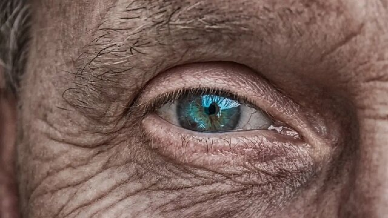 استرسِ همیشگی باعث پیرچشمی می‌شود