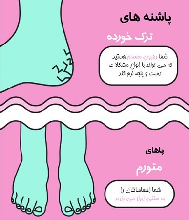 ترک پا