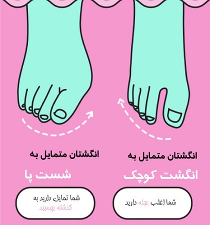 انگشتان کج