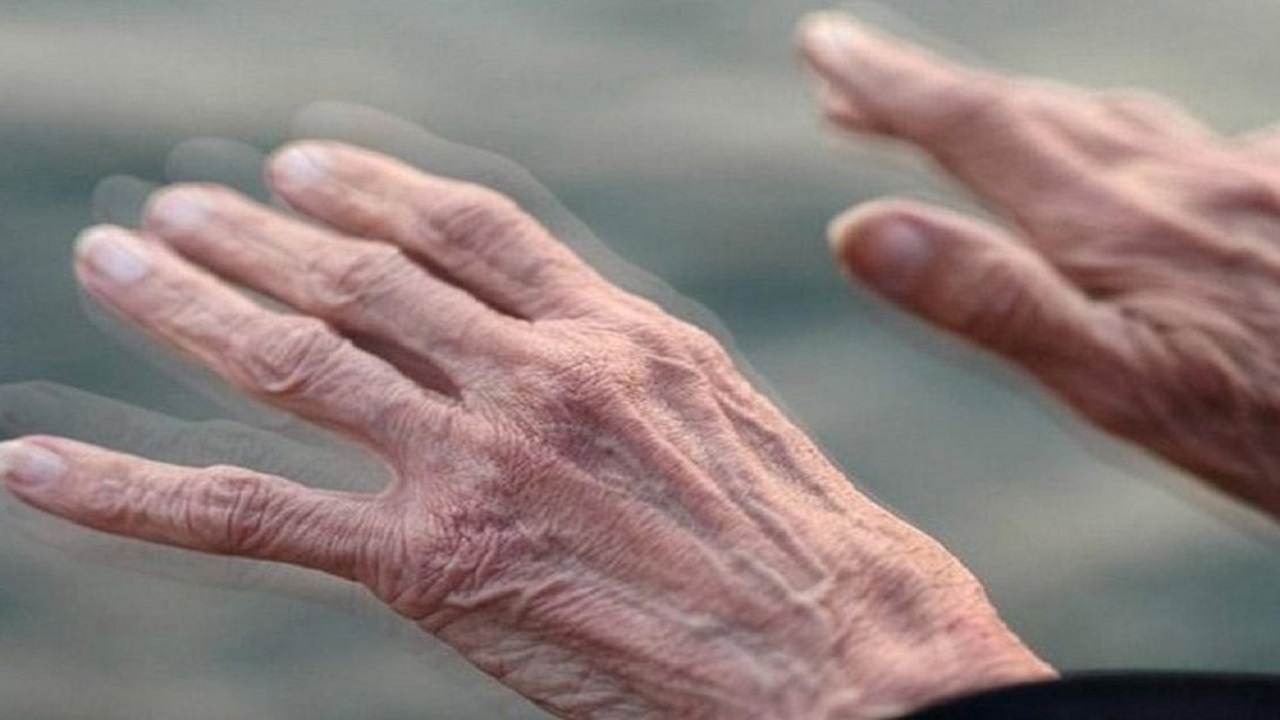 هر لرزشی در دستان پارکینسون نیست + فیلم