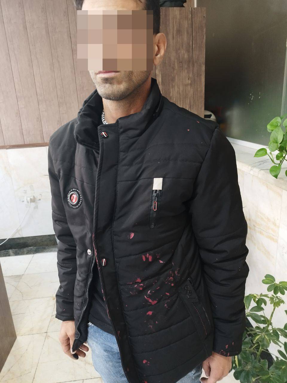 دستگیری عامل اسیدپاشی در خیابان دامپزشکی تهران دستگیری عامل اسیدپاشی در خیابان دامپزشکی تهران