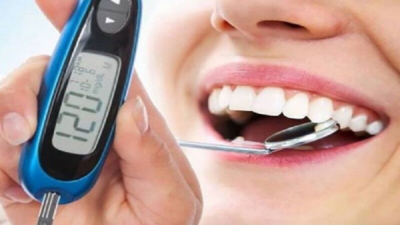 معاینات دندانپزشکی یکی از راههای تشخیص دیابت است