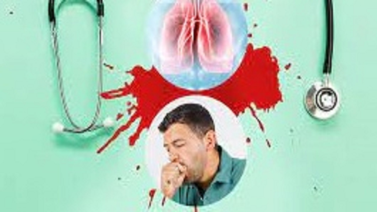 ۲۰ درصداز مبتلایان بیماری سل در خراسان رضوی اتباع خارجی را در بر می گیرد