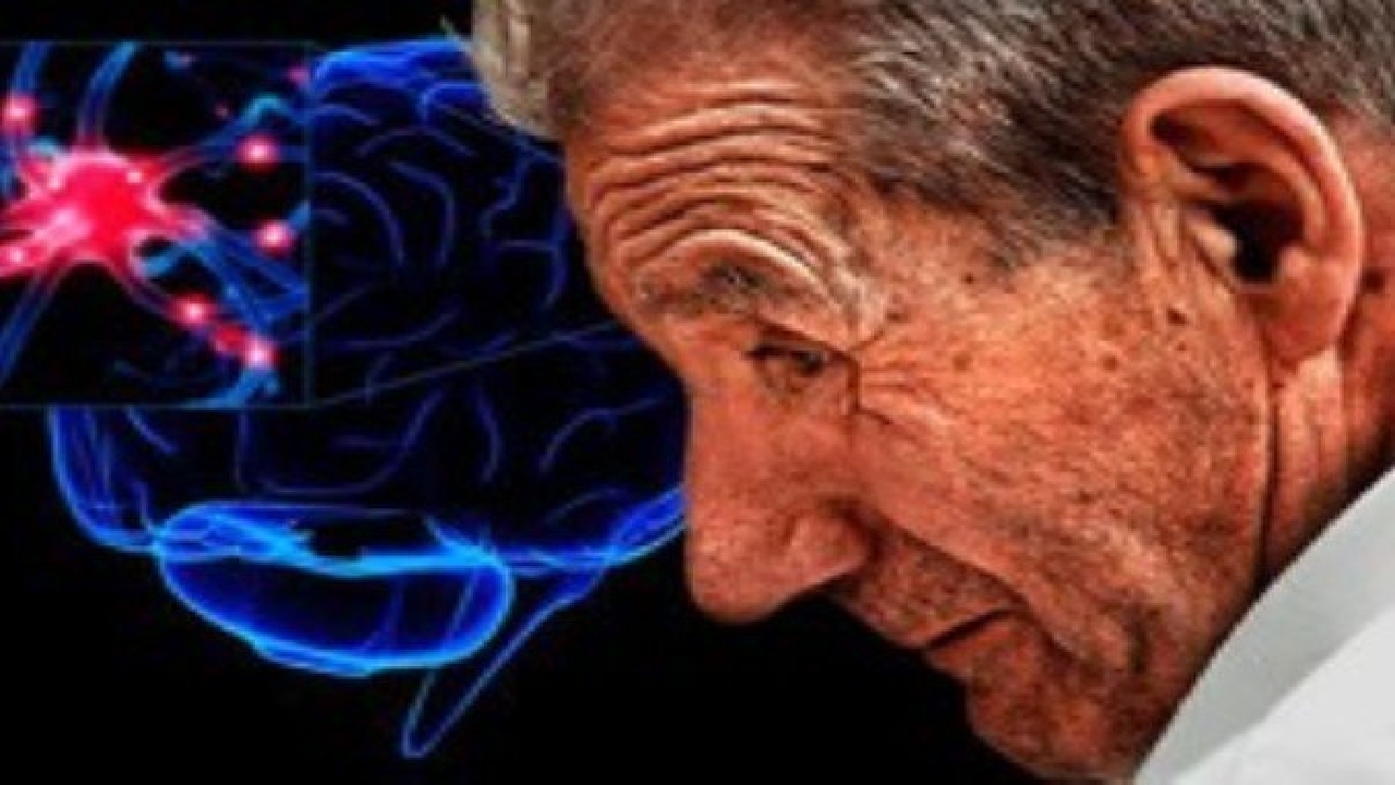 تاثیر ورزش در بیماران مبتلا به پارکینسون