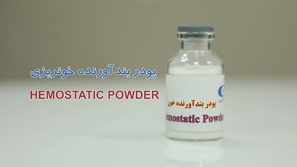 کیست تخمدان مشکلی شایع در بیشتر زنان + فیلم