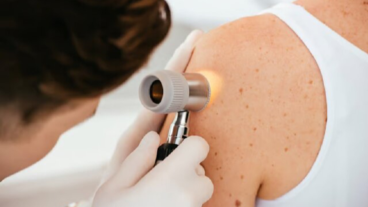 فناوری mRNA خطر مرگ ناشی از سرطان پوست را نصف می‌کند
