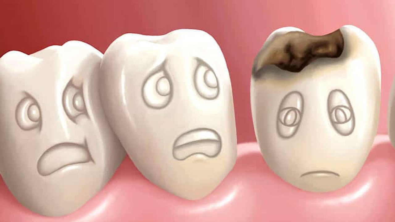 تعداد زیادی از ایرانیان خارج از کشور برای درمان دندان‌هایشان به ایران می‌آیند