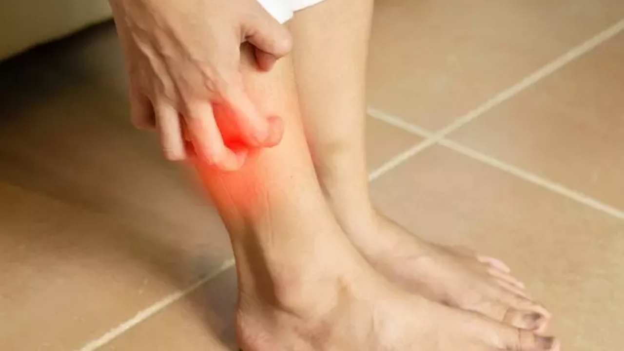 درمان خارش و واریس پا از نگاه طب سنتی