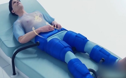 ساخت دستگاه پیشرفته تسهیل کننده گردش خون + فیلم