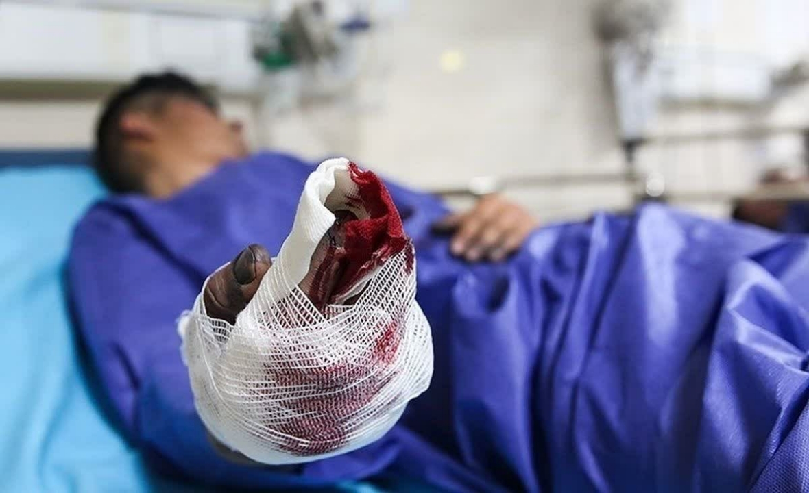 قطع عضو یک نفر در حادثه چهارشنبه آخر سال قم