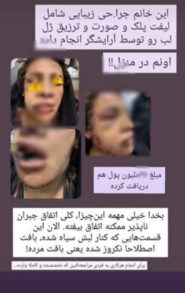 جراحی غیر قانونی