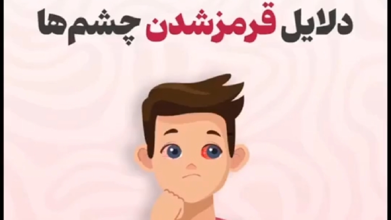 چه زمانی باید برای قرمز شدن چشم‌ها به پزشک مراجعه کرد؟ + فیلم