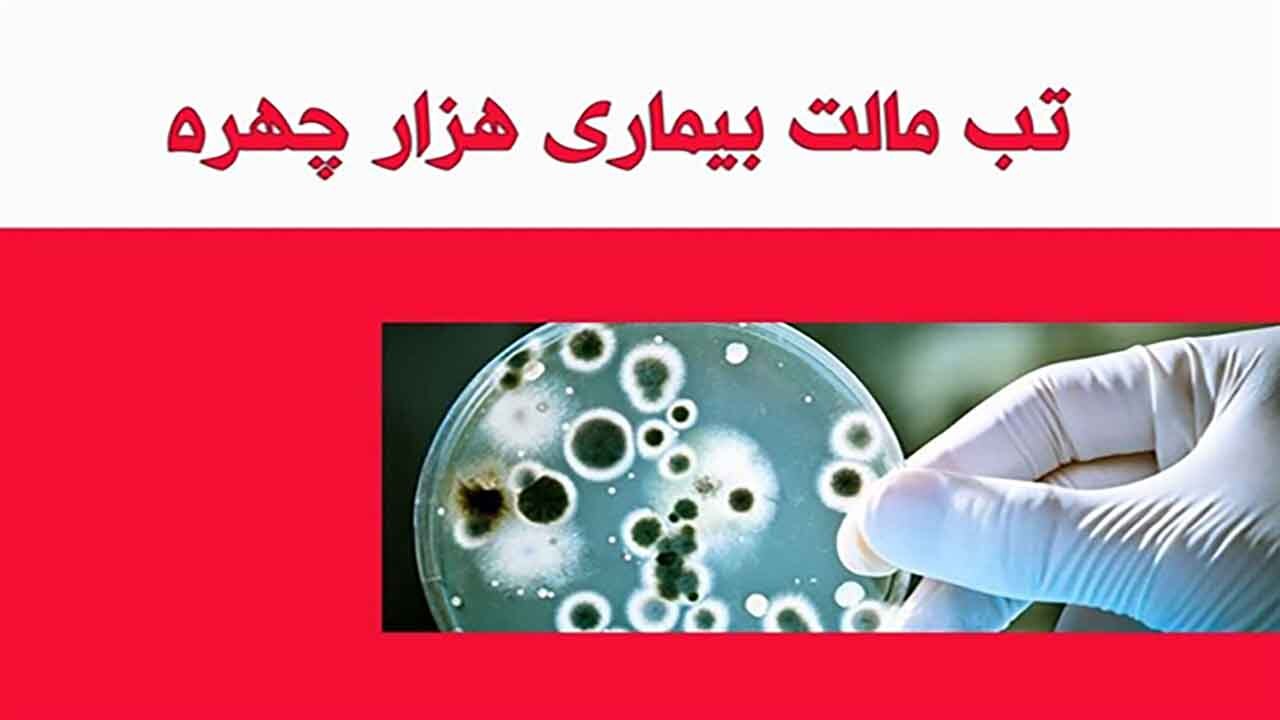 احتمال افزایش ابتلا به بیماری تب مالت با مصرف فراورده‌های لبنی غیرپاستوریزه