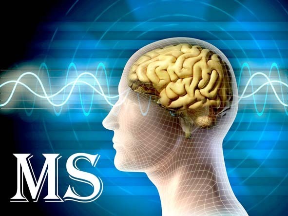 ارائه خدمات درمانی به بیش از ۸ هزار بیمار مبتلا به MS در شیراز