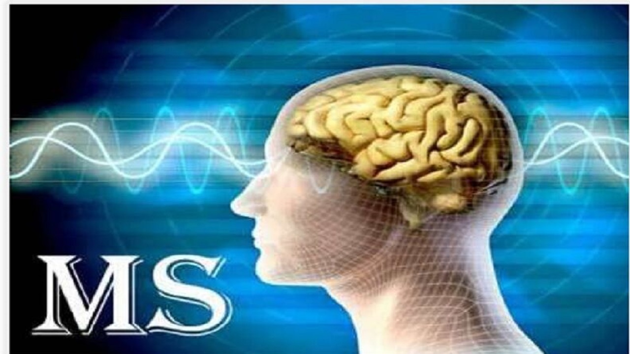 شناسایی یک هزار و ۴۶۲ بیمار مبتلا به ام اس در استان اردبیل