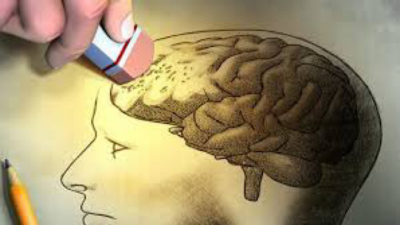 بستری بیش از یک میلیون آمریکایی مبتلا به زوال عقل در سال
