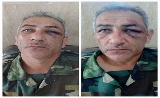 ضرب و شتم یک جنگلبان در لوندویل آستارا