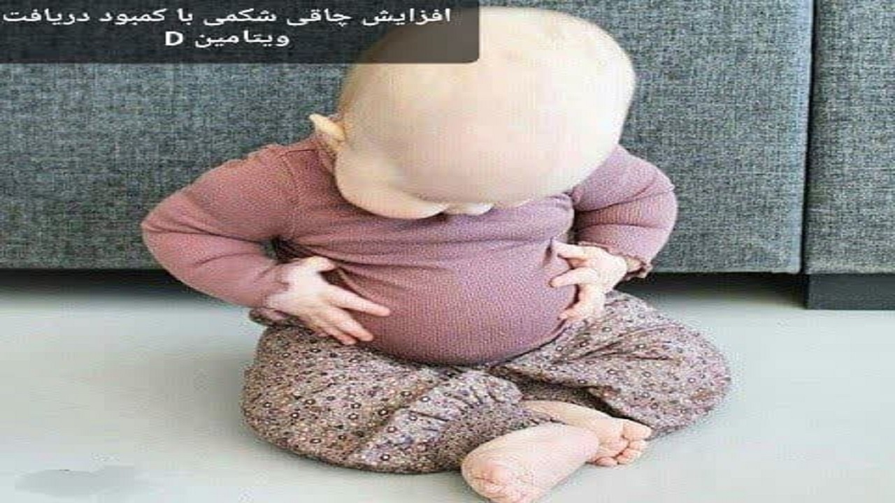 افزایش چاقی شکمی انسان با کاهش دریافت ویتامین D