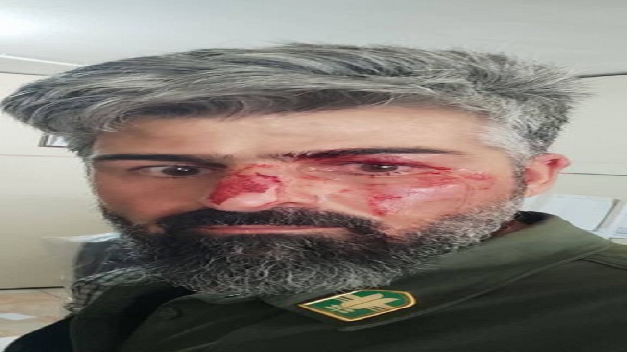 جزئیات حادثه ضرب و شتم محیط بان کرمانشاهی توسط شکارچیان غیرمجاز