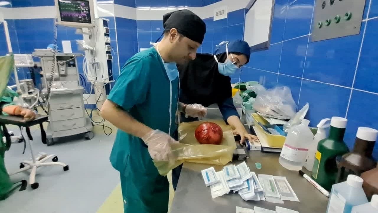 خارج کردن توده ۳/۵ کیلویی از کلیه یک مرد