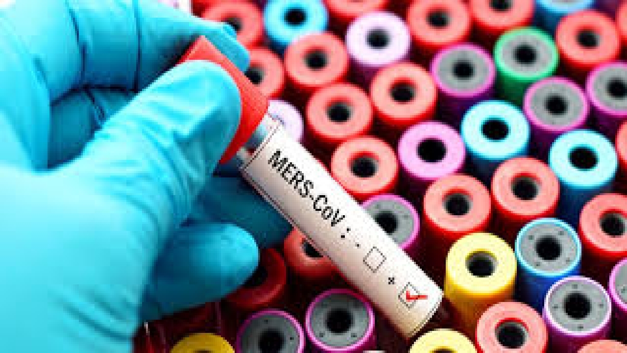 هشدار سازمان جهانی بهداشت نسبت به ویروس MERS-CoV