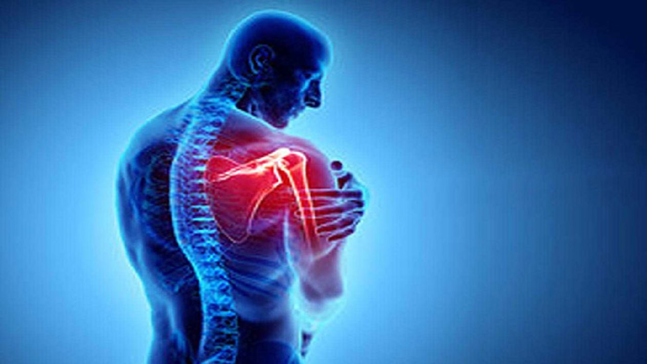 همه آنچه درباره بیماری «شانه یخ زده» باید بدانیم+فیلم