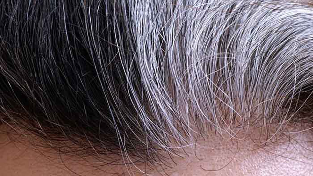 راهکار پیشگیری از سفید شدن موی سر + فیلم