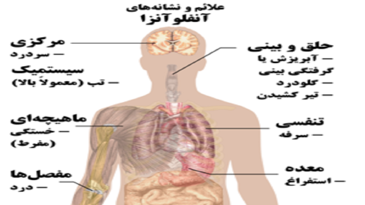 شیوع موج آنفلوآنزا در سطح کشور و کرمانشاه