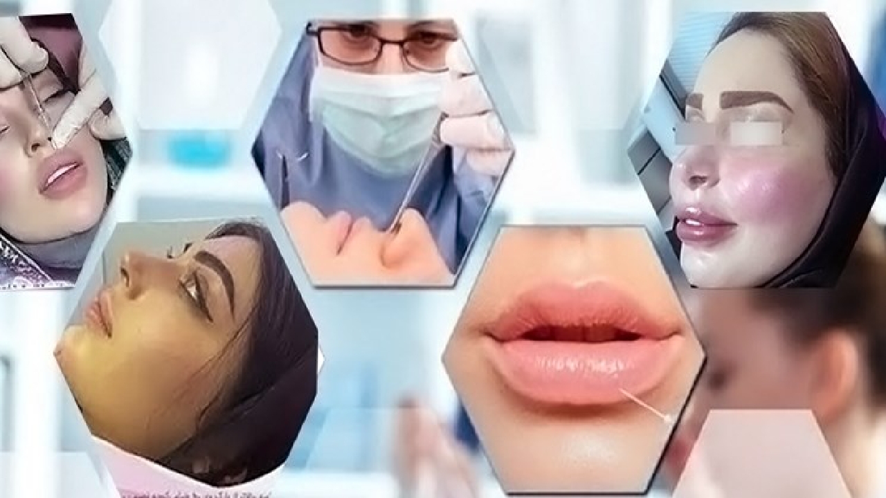 رد پای ژل‌های سرطانی بر صورت دختران ایرانی‌