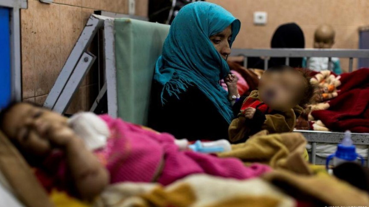 سوء تغذیه ۴ میلیون مادر و کودک در افغانستان
