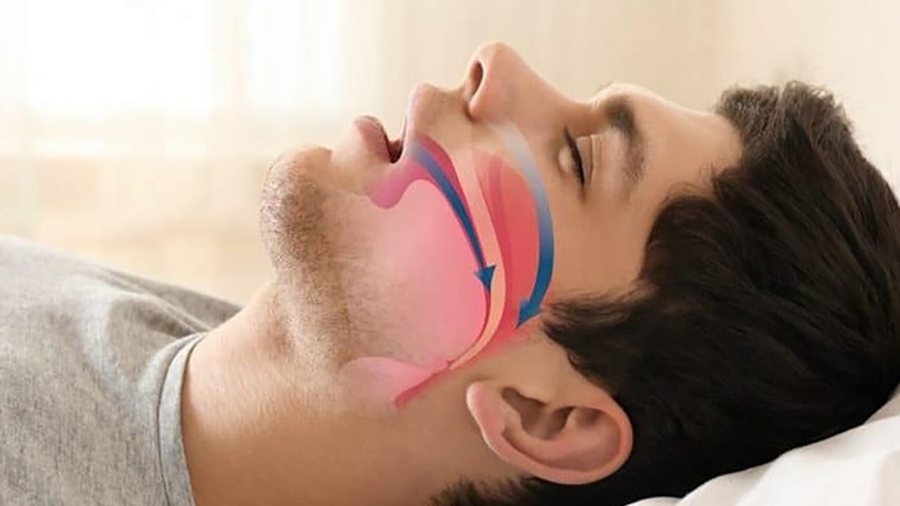 راهکارهای درمانی خروپف کردن در طب سنتی + فیلم