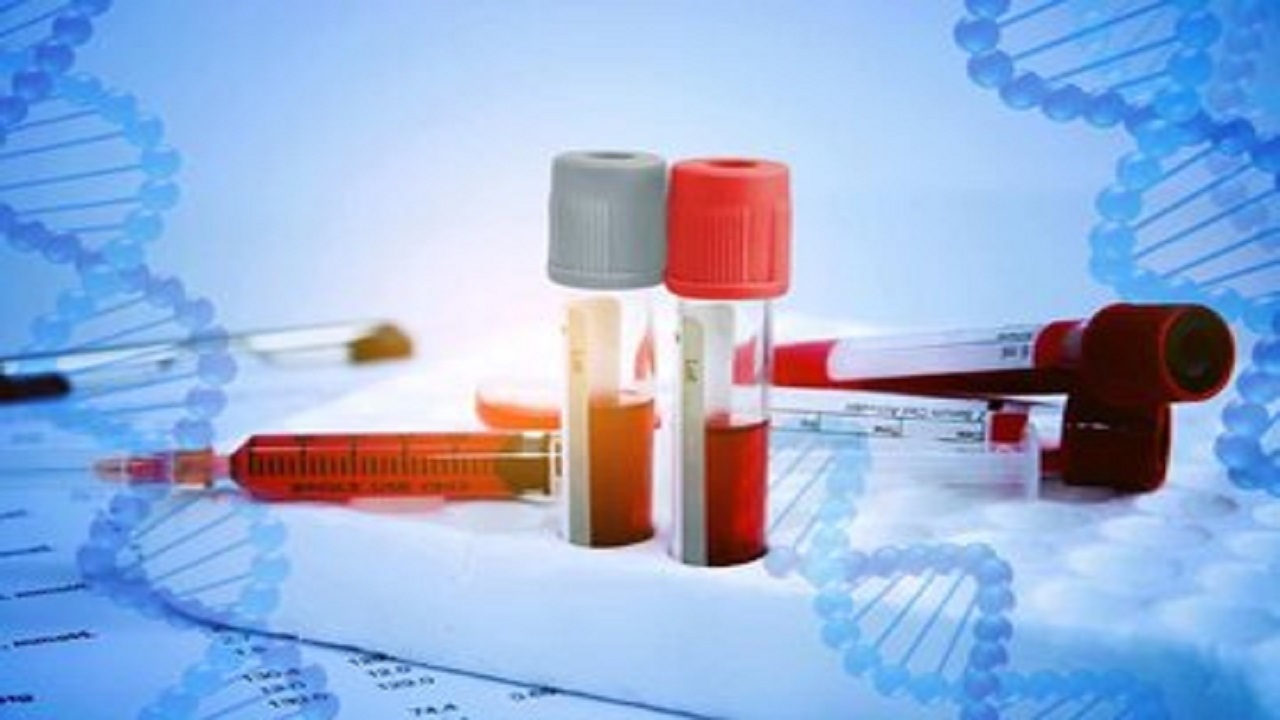 تولید کیت‌های تشخیص انواع هورمون‌ها توسط دانش بنیانی‌ها