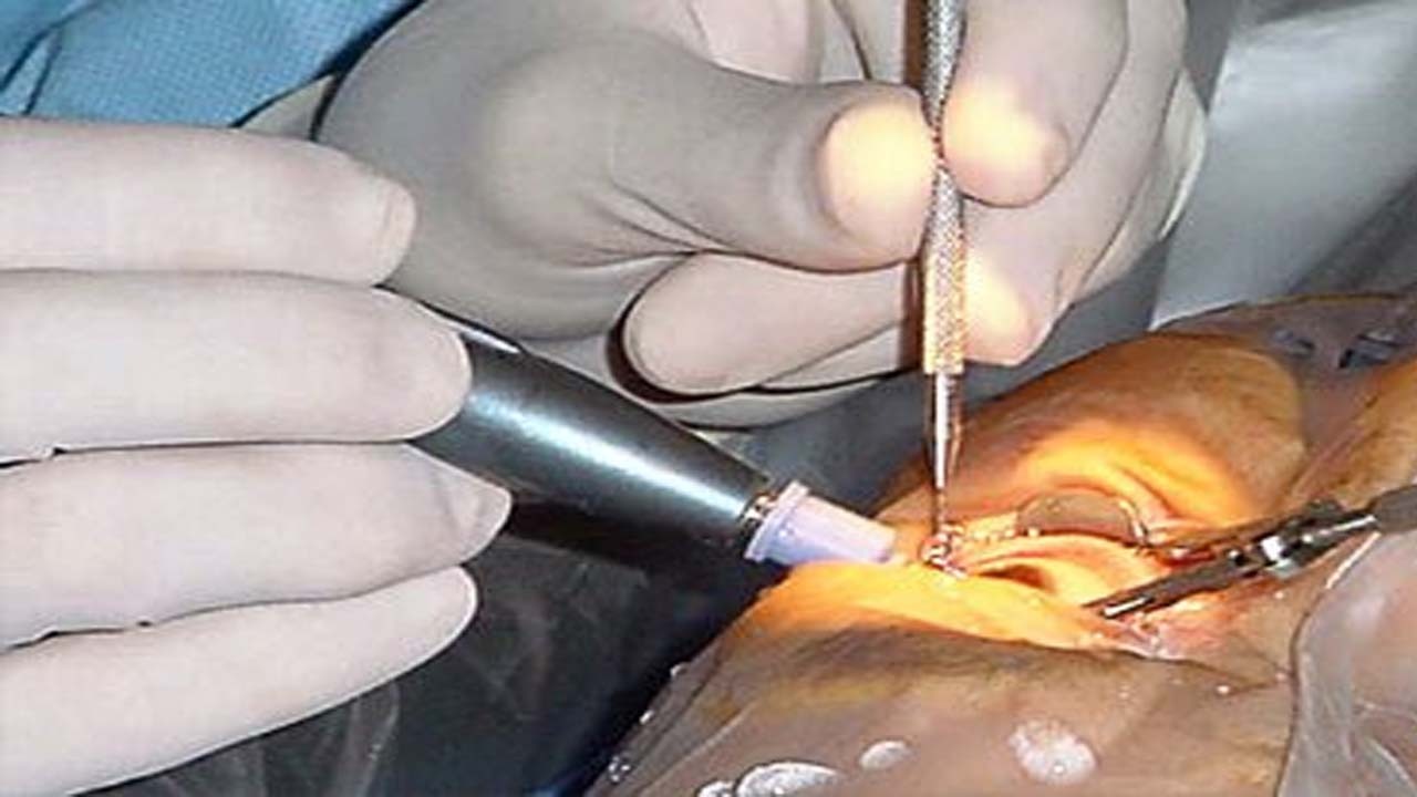 تغییر رنگ چشم دغدغه جدید زیباجویان!