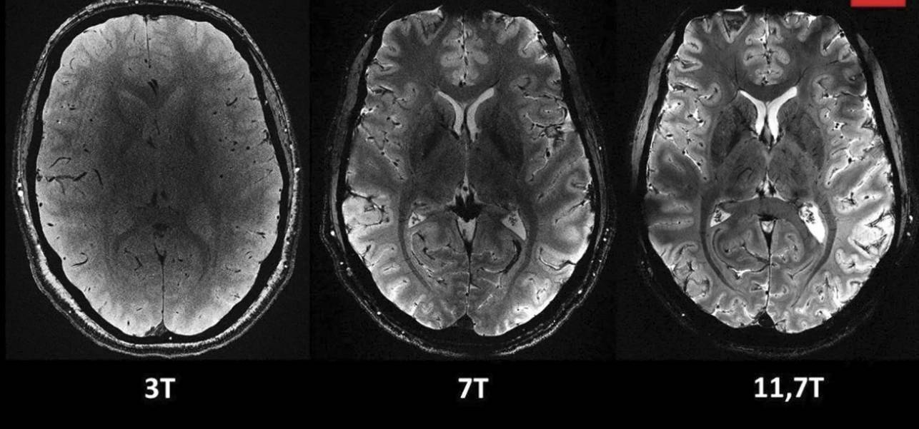 قدرتمندترین دستگاه MRI جهان