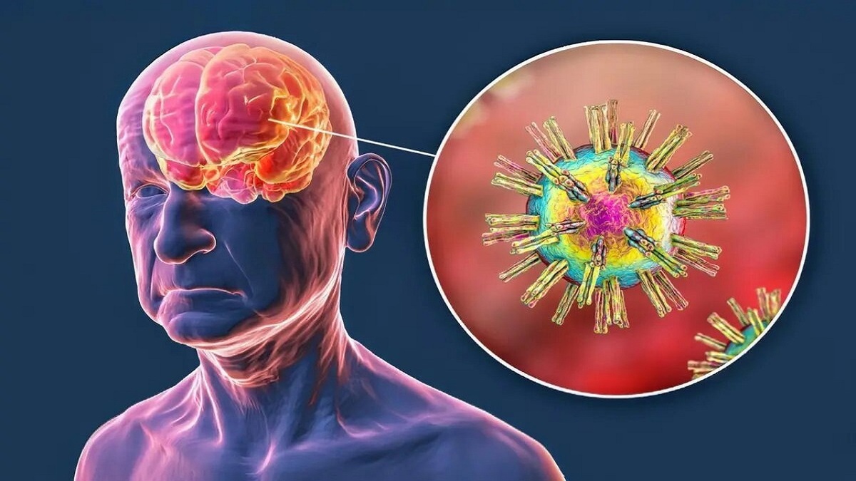 باشگاه خبرنگاران -ضربه به سر، ویروس‌های خفته مغز را بیدار می‌کند