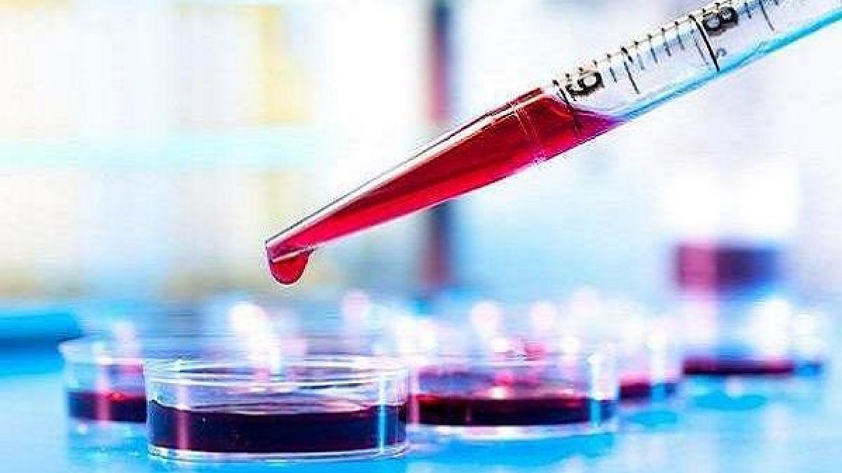 باشگاه خبرنگاران -تشخیص دقیق سرطان روده بزرگ با آزمایش خون