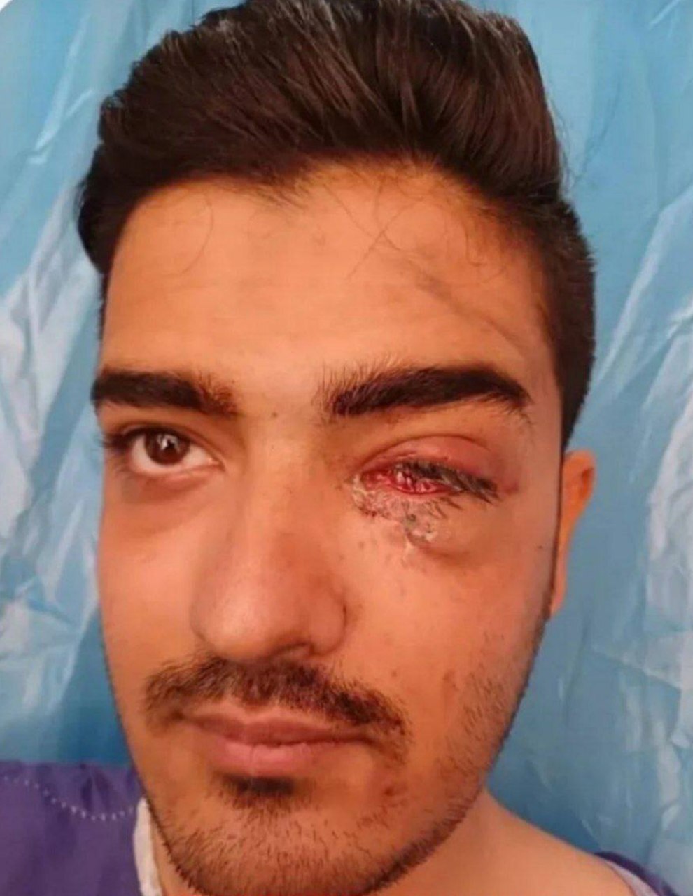 پاسخگوی چشم از دست رفته هوادار پرسپولیس چه کسی خواهد بود؟