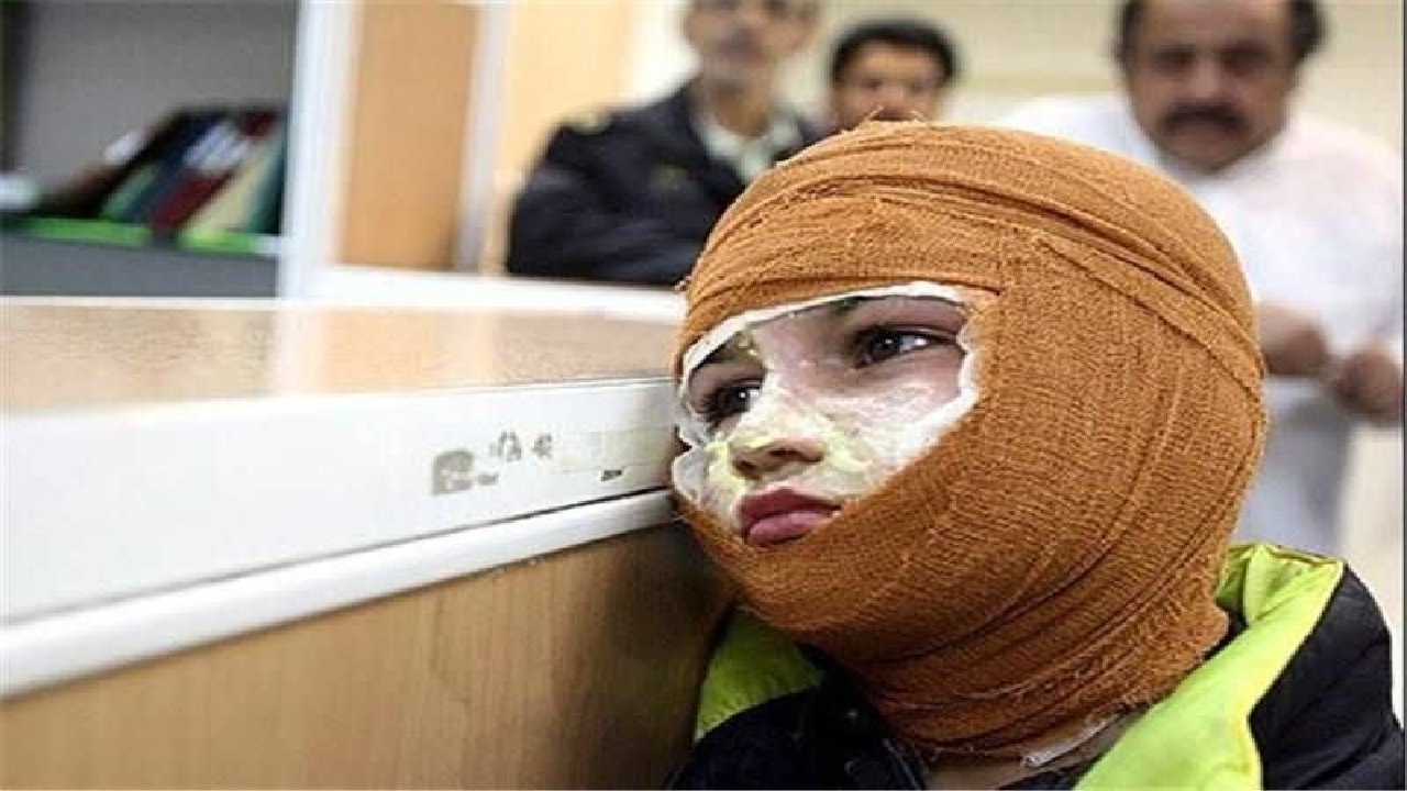 افزایش تعداد مصدومان چهارشنبه‌سوری لرستان به ۶۳ نفر