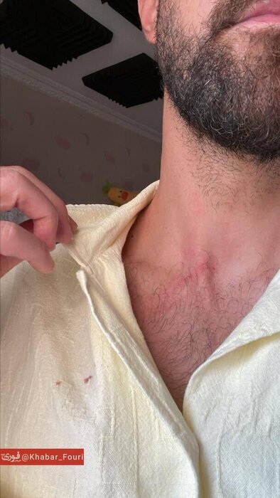 حمله سارقان به مهاجم سابق استقلال تهران