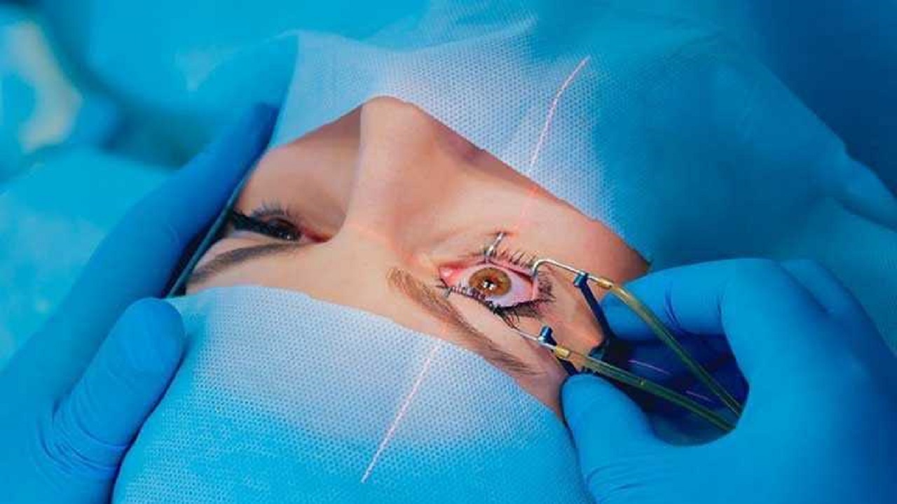 نحوه عمل لازک چشم + فیلم