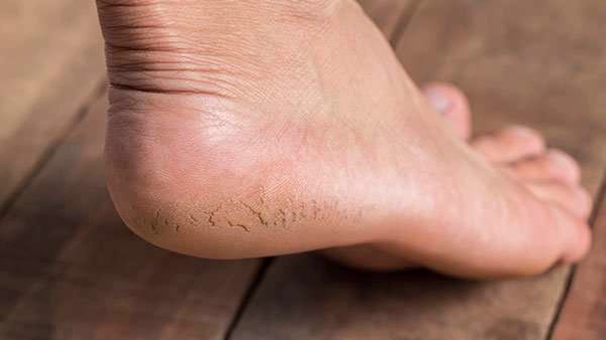 خواص ویژه گل محمدی برای کاهش استرس + فیلم