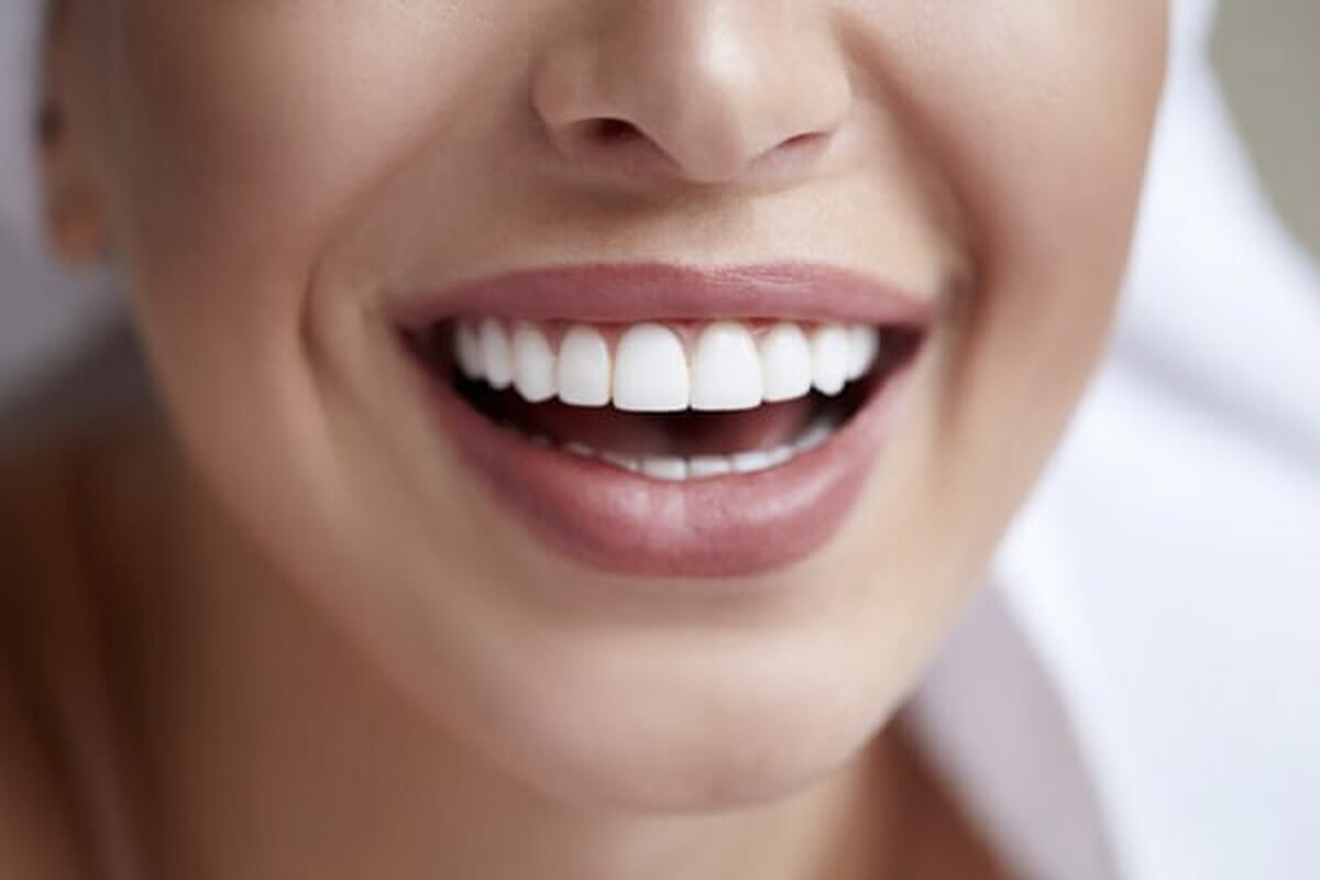باشگاه خبرنگاران -قانون طلایی برای داشتن دندان‌های بی نقص