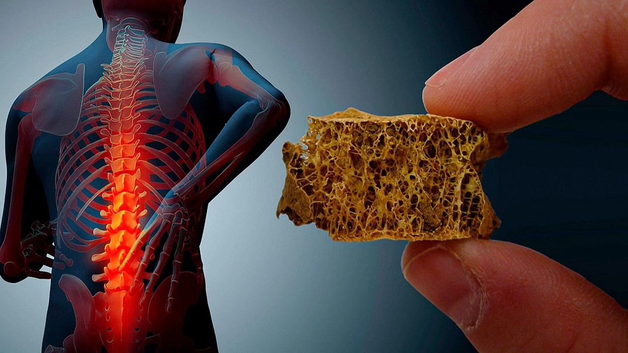 استفاده از پودر سنجد برای جلوگیری از پوکی استخوان + فیلم