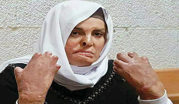 زن اسیر فلسطینی اسرای فلسطینی