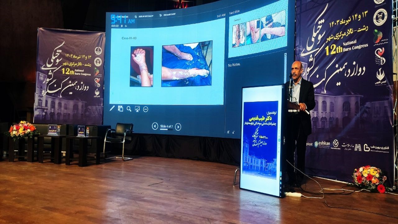 لزوم بهره گیری از هوش مصنوعی در پیشگیری از سوختگی‌ها