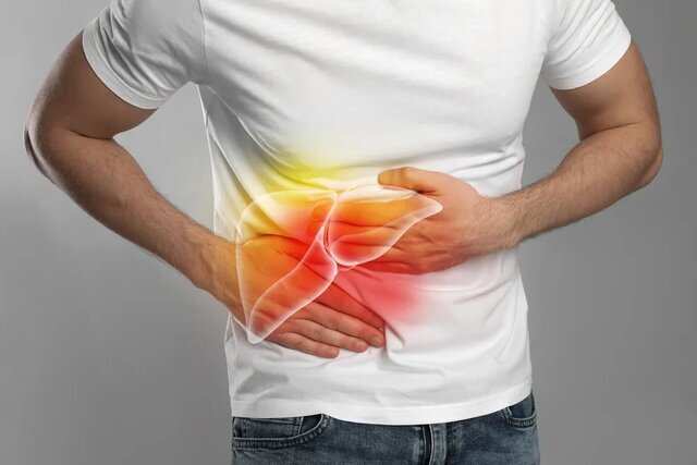 علائم سیروز کبدی