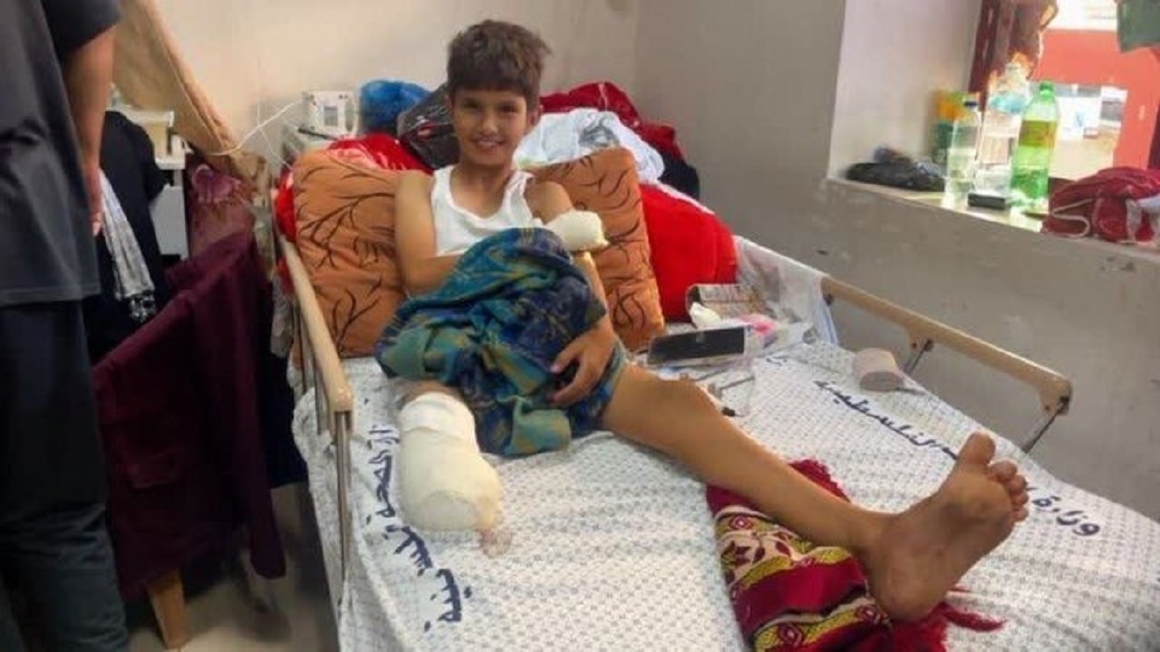غزه باید متناسب با حال قطع عضو شدگان بازسازی شود